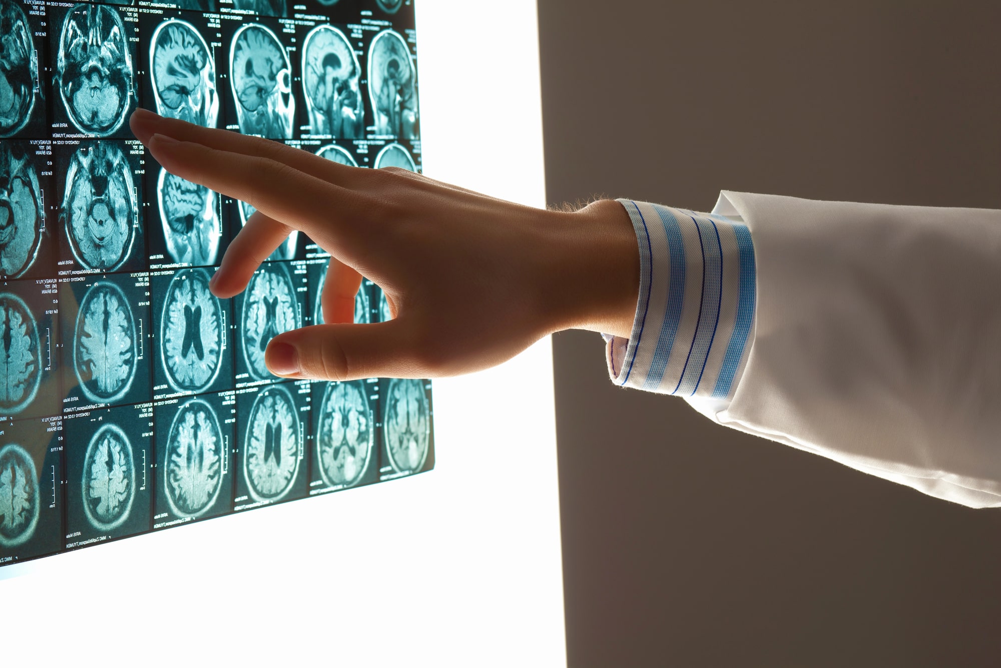 Catastrophic Brain Injury Effects And Catastrophic Injury Lawyer Bartlett, TN